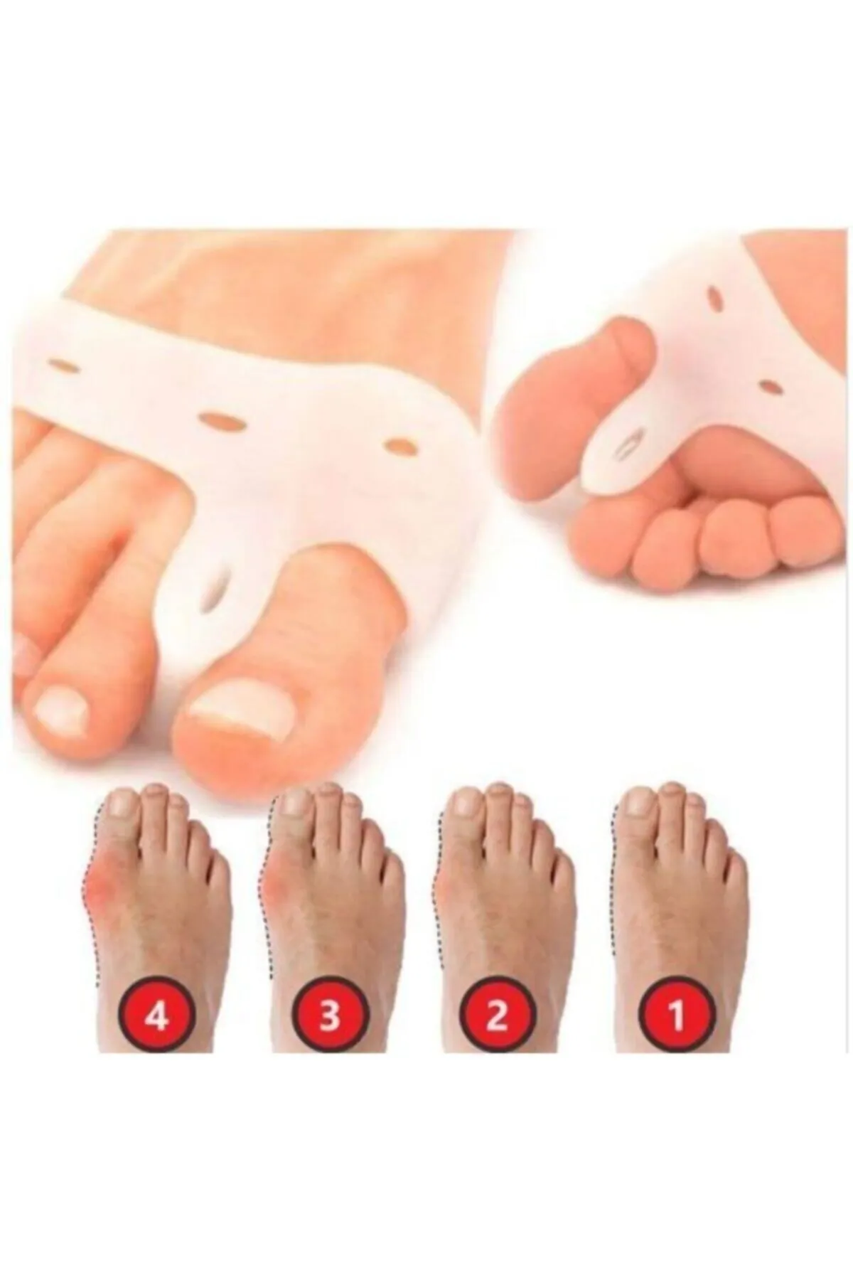 Silikon Makaralı Ayak Baş Parmak Kemik Koruyucu Bunyon